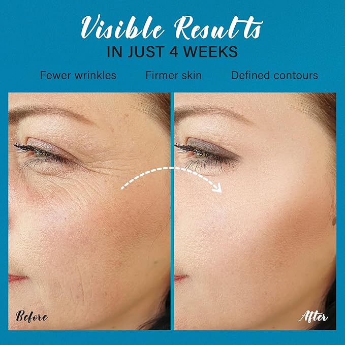 Tighten and Lift Neck Cream: Instant Face Lift Cream - 6-in-1 Anti-Aging Face Moisturizer for Anti-Wrinkle, Firm - Collagen, Retinol, Peptides & Hyaluronic Acid Neck Firming Cream for Skin Care-VivaGrace Women