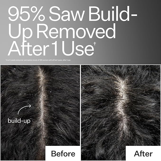 ACT+ ACRE Cold Processed Scalp Detox Oil - Sulfate-Free Care for Flaky, Dry and Itchy Scalp - Promotes Thicker, Fuller-Looking Hair-VivaGrace Women