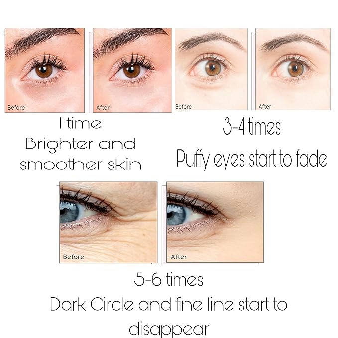 Under Eye Bags Treatment, Rose Eye Mask, Eye Treatment Mask, For Moisturizing,Revitalizing, Lift & Firm, Anti- Dark Circle, Depuffing. Cruety-Free. (60 Pieces)-VivaGrace Women