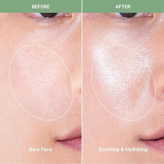 Meebak CICA Toner Spray | Korean Face Mist | Facial Spray with Centella Asiatica & Vitamin E | Soothing Face Toner for Sensitive, Oily, and Combination Skin | 4 fl oz-VivaGrace Women