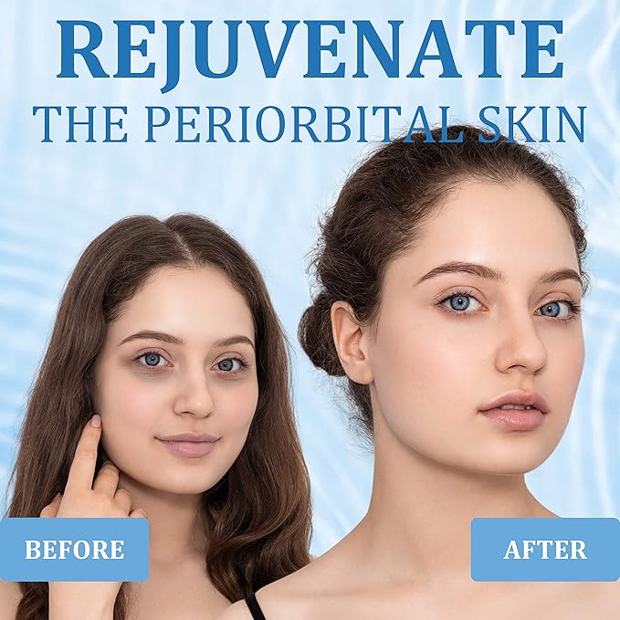 Under Eye Patches, Hyaluronic Acid Eye Mask, Collagen Eye Pads for Dark Circles, Eye Bags, Puffiness, Diminish Fine Lines and Wrinkles, Moisturize and Tighten Eye Skin for Men and Women-VivaGrace Women