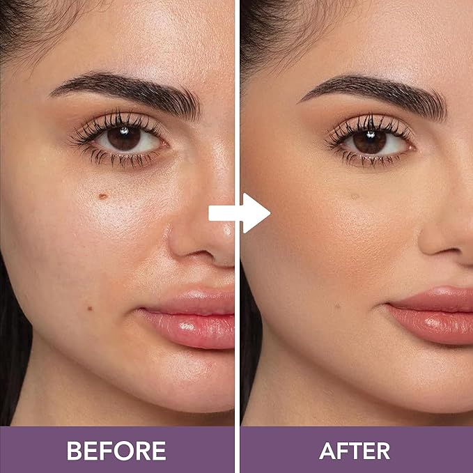 Dermaflage Full Coverage Concealer Cream, Tan, 11 Versatile Shades, Waterproof, Non-Greasy, Matte Finish, Conceals Acne, Dark Circles, Blemish Spots, Tattoos, Bruises, Scars-VivaGrace Women