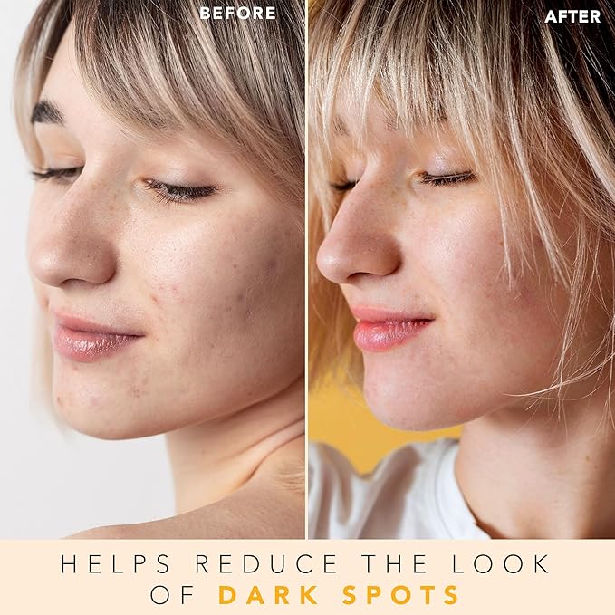 Vitamin C Face Toner - USA Made with Natural & Organic Ingredients, Alcohol-Free Skin Brightening Facial Toner for Sensitive and Aging Skin, Pore Minimizing Face Mist for Women and Men-VivaGrace Women