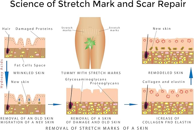 Best Stretch Marks Cream Prevent & Reduce Marks Reduce Pregnancy Stretch Marks Highly Concentrated Cream includes $29 Scar Reducing Guide-VivaGrace Women