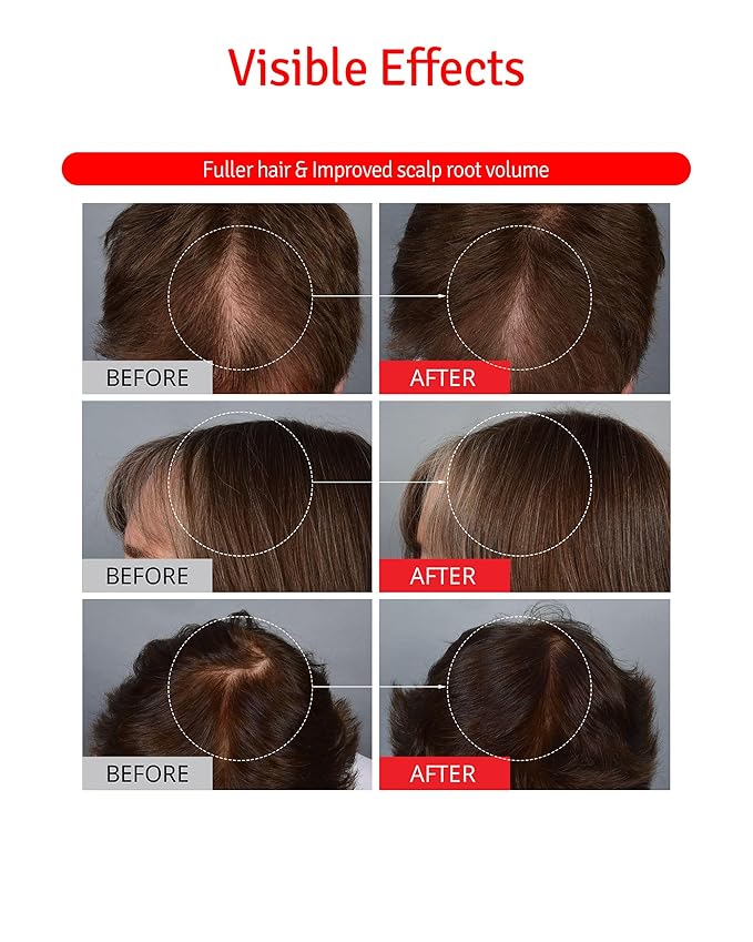 Scalp+ Shampoo for DHT Blocker, Hair Loss Relief - Moisture Anti-Aging Thickening Volumizing Fortifying & Repairing Hair Strength Fuller Hair with Vitamin C, Peptides, Biotin, 10.14 fl.oz.-VivaGrace Women