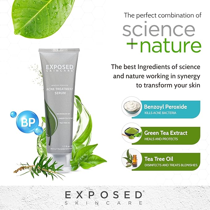 Exposed Skin Care Acne Treatment Serum Step 3 – Quickly Reduces Pimple Size and Redness - 12 Hour Spot Treatment - 3.5% Benzoyl Peroxide, Natural Green Tea & Tea Tree Oil-VivaGrace Women