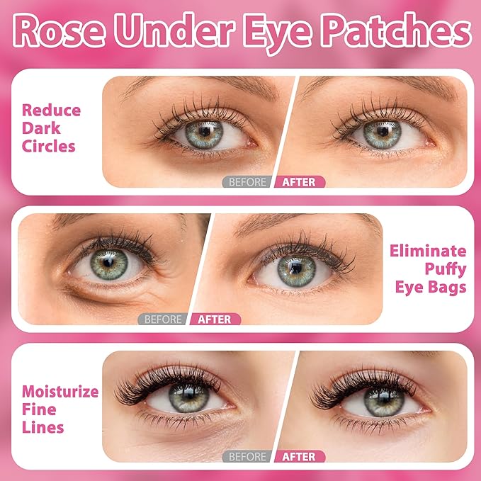 Eye Mask, Pink Rose Under Eye Patches (20 Pairs) Pink Rose Under Eye Masks Hyaluronic Acid Eye Patches for Dark Circles and Puffiness, Reduce Wrinkles and Fine Lines Under Eye Area - Pink-VivaGrace Women