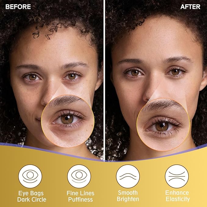 Under Eye Patches for Puffy Eyes and Dark Circles (20 Pairs), Under Eye Gold Mask with Hyaluronic Acid & Collagen to Reduce Wrinkles and Relieve Pressure, Eye Care Treatment for Men & Women Gift-VivaGrace Women