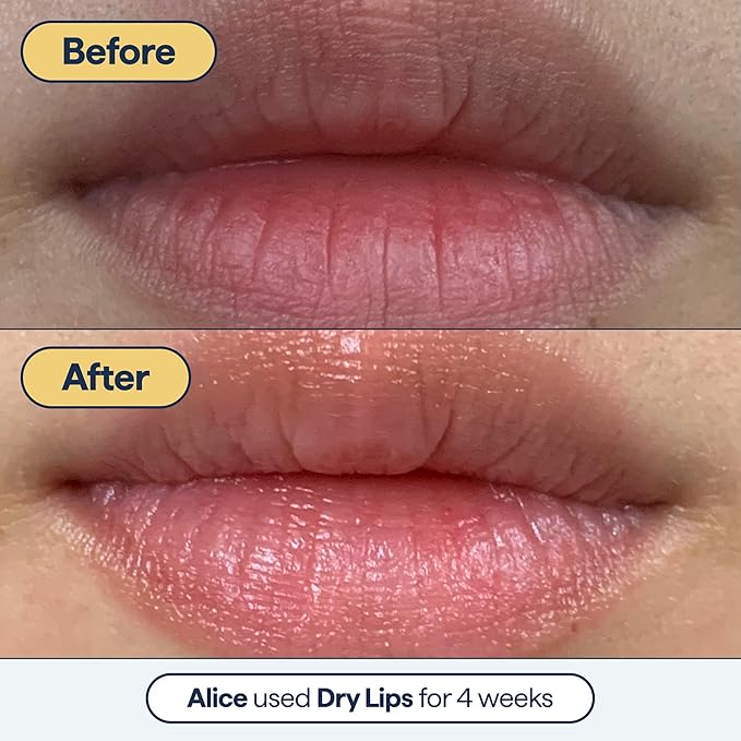 Remedy for Dry Lips - Hydrating and Healing Lip Balm Ointment with Ceramides, Peptides, and Dimethicone - Repairs Dry, Cracked Lips - By Dermatologist Dr. Shah-VivaGrace Women