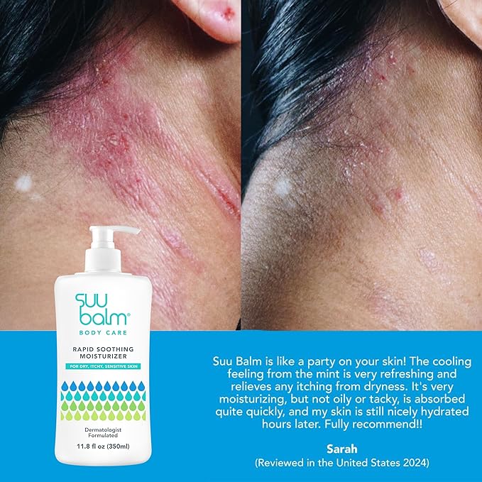 Fast Itching Relief Cream, Anti Itch Lotion for Sensitive Skin, Eczema, Psoriasis & Extreme, Very Severe & Dry Skin, Derm Formula, Menthol & Ceramides, 11.83 fl oz-VivaGrace Women