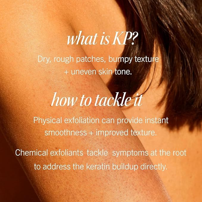 First Aid Beauty - KP Bump Eraser Body Scrub with 10% AHA, Keratosis Pilaris Exfoliator with Glycolic and Lactic acids, Helps Reduce Chicken Skin Bumps, Safe for Sensitive Skin, Peach Scent (8 oz)-VivaGrace Women