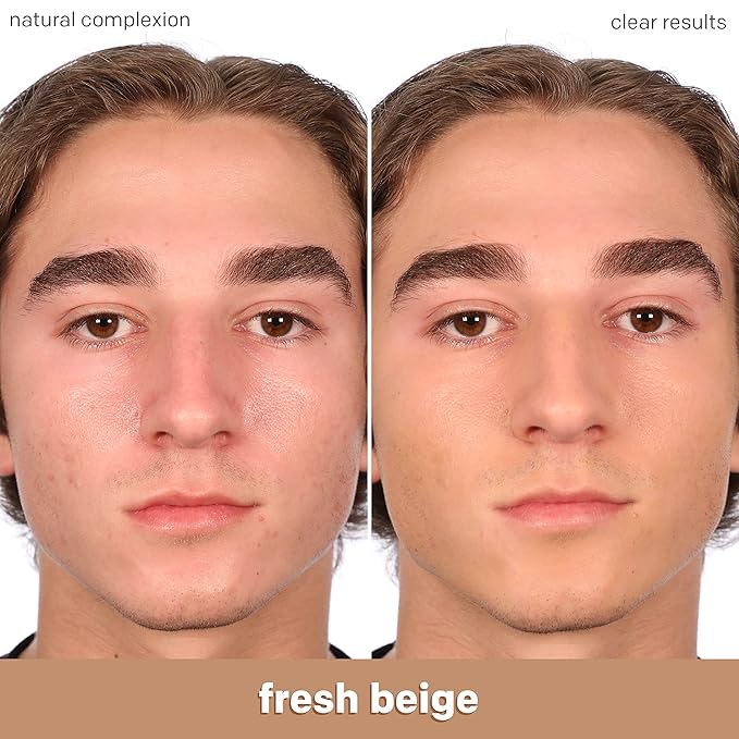 Almay Clear Complexion Acne Foundation Makeup with Salicylic Acid - Lightweight, Medium Coverage, Hypoallergenic, -Fragrance Free, for Sensitive Skin , 700 True Beige, 1 fl oz.-VivaGrace Women