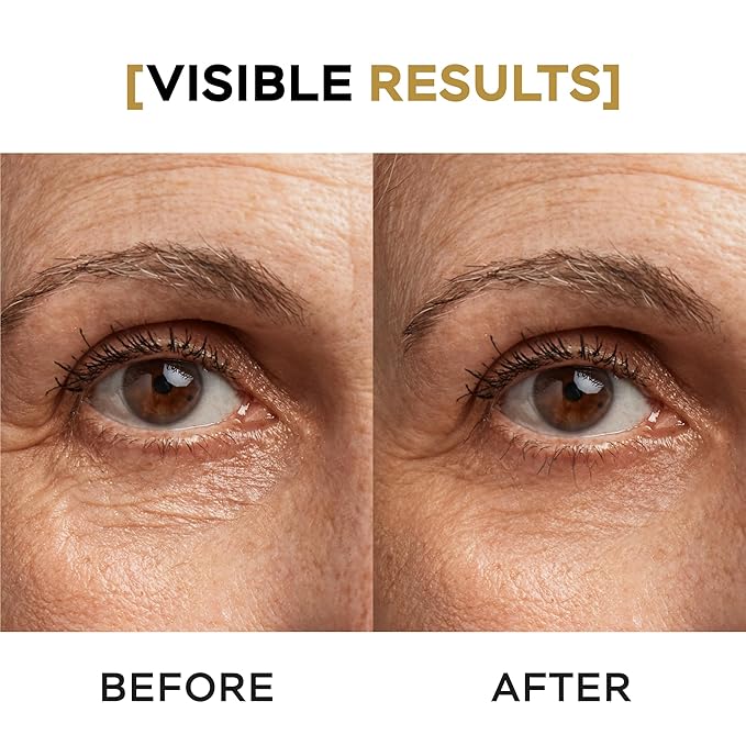 Moisturizing Eye Cream w/Aloe Vera, Collagen, Hyaluronic Acid, Cotton Stem Cells for Dark Circles, Puffiness & Bags - Under Eye Hydration Cream for Women & Men (1 Fl Oz)-VivaGrace Women