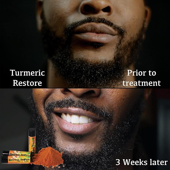 Turmeric Lip balm | Turmeric Restore | Natural Lip Balm | Organic Lip Balm | Natural Lip Balm | Lip Moisturizer | 100% Natural Ingredients | Habbie Beauty Supplies (6 Pack)-VivaGrace Women