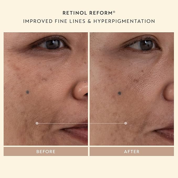 SHANI DARDEN SKINCARE Sculpt & Firm Travel Kit, Facial Sculpting Wand, Attachments, Retinol Reform & Lactic Serums, Peptide Cream & Pep Gel, 7 Items-VivaGrace Women