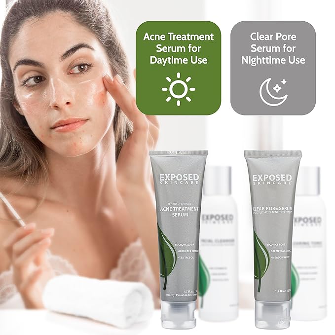 Exposed Skin Care Basic Acne Treatment Kit - Includes Salicylic Acid Face Wash, Clearing Tonic, Treatment Serum with Benzoyl Peroxide, Clear Pore Serum - Natural Acne Solution for All Skin Types-VivaGrace Women