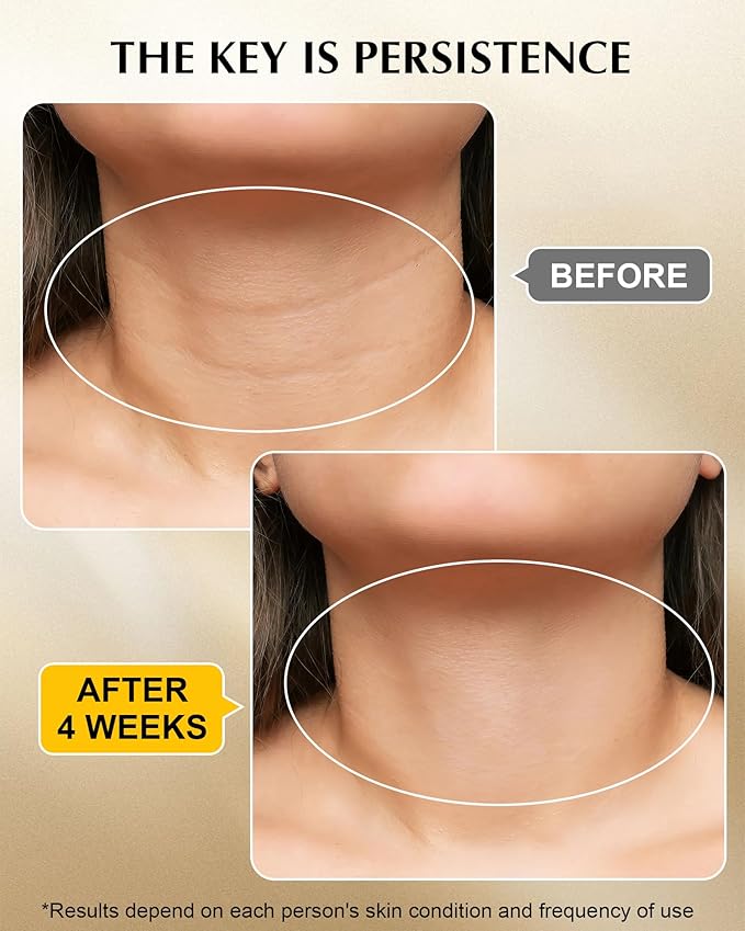 Neck Firming Cream with 3% Retinol - Hyaluronic Acid, Anti-Wrinkle Treatment, Skin Tightening Cream for Face, Neck, Chest & Décolleté-VivaGrace Women