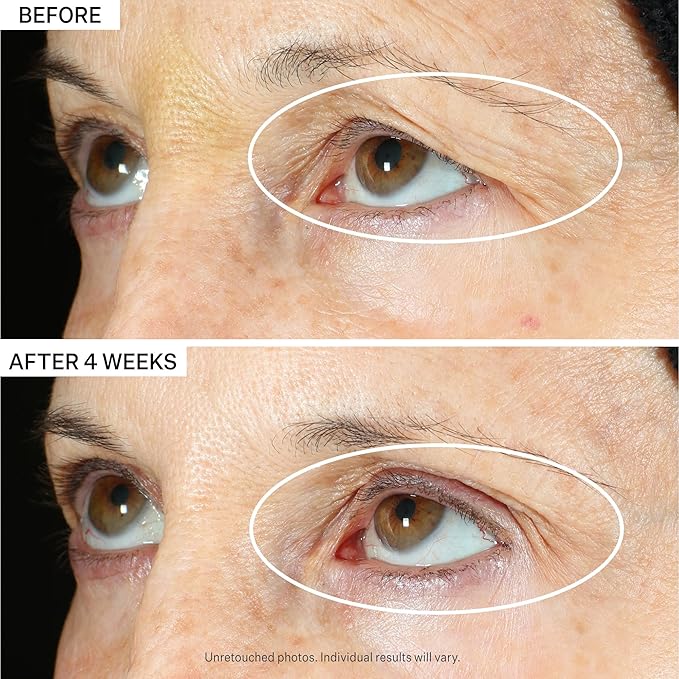 StriVectin Tighten & Lift Peptight 360 Degree Eye Serum with Tightening & Brightening Peptides for Wrinkles, Under Eye Bags and Puffiness, 1 fl. Oz-VivaGrace Women