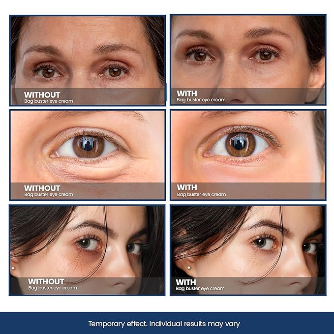 Bag Buster Eye Cream | Instant Reduction | Rapid Eye and Face Lift | Anti-Aging | instantly Reduces, Wrinkles, Dark Circles, Fine Lines, Under Eye Bags | Powdery Residue Or Flakes Free Formula | 10ml-VivaGrace Women