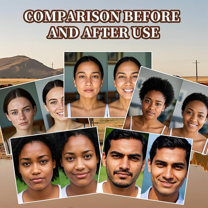 Beef Tallow for Skin, Tallow and Honey Balm, Facial Moisturizer Cream, 100% Organic Grass Fed Whipped Beef Tallow Balm Deeply Moisturizing for Face & Body, Suitable For All Skin Types(3.53oz)-VivaGrace Women