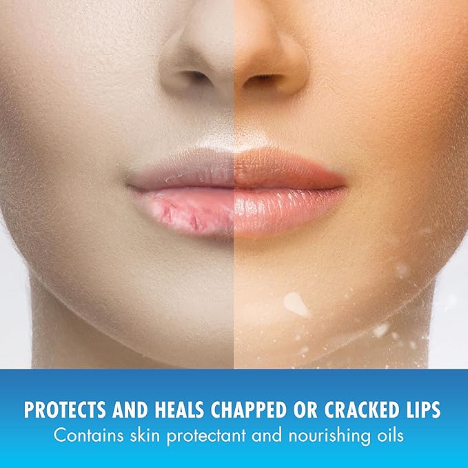 Mentholatum (R) Natural Ice (R) Sport Broad Spectrum SPF 30 Medicated Lip Balm - 12 Pack of 4.5 g Tubes-VivaGrace Women