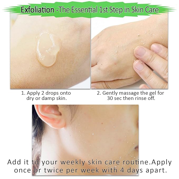 Facial Exfoliating Gel, Non-Scrub Gentle Exfoliantor for Face & Body, Exfoliates, Peels, and Removes Dead Skin Cells, Reveals Glowing, Brighter Skin, 150 ml/5 fl oz