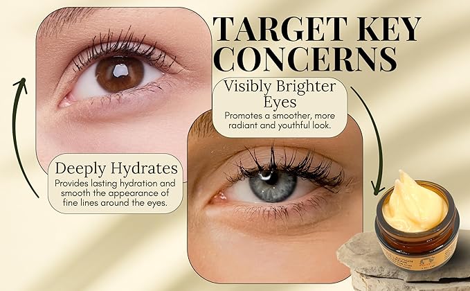 Anti-Aging Eye Cream with Squalane, Nicotinamide, and Panthenol (B5) for Dark Circles, Puffiness, and Fine Lines - 1oz-VivaGrace Women