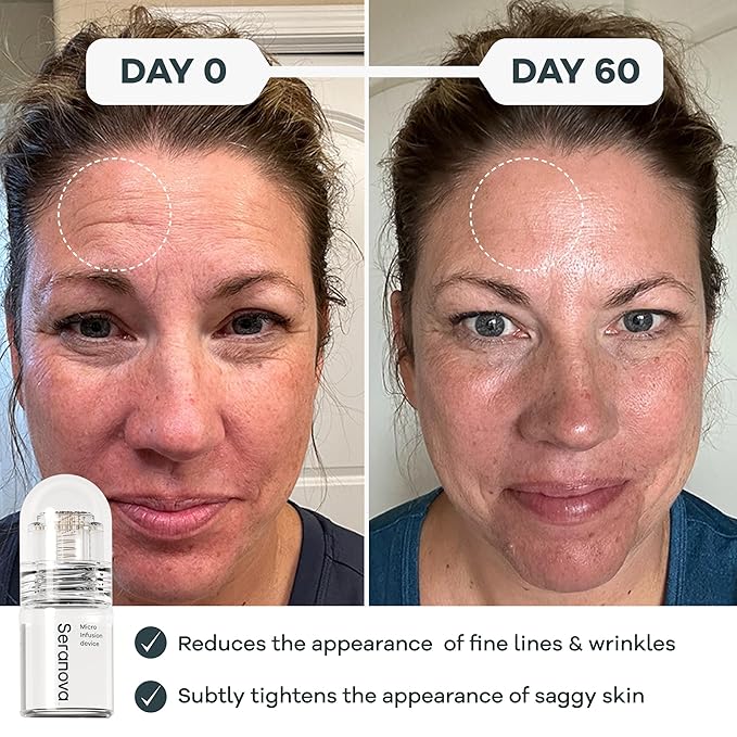 Seranova - Micro Infusion for Skin Care (2-Month Supply)-VivaGrace Women