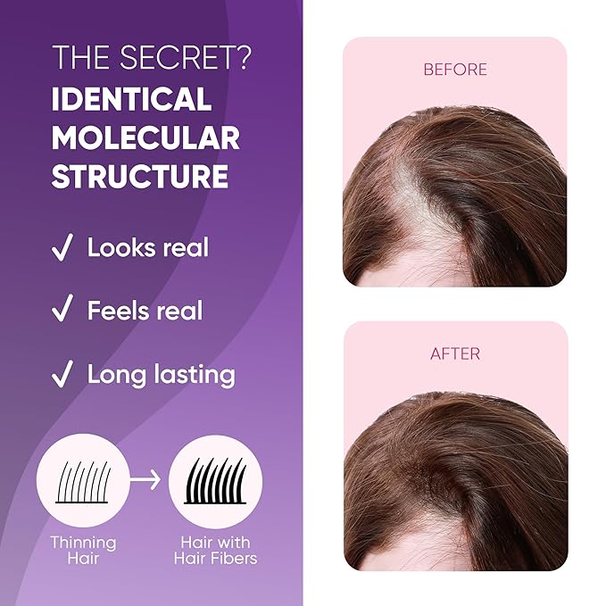 GBG Hair Fibers for Thinning Hair & Bald Spots (Light Brown) - 25g Bottle - Conceals Hair Loss - Instant Cover Up & Volume in 30 Seconds, Hair Powder for Women & Men - Cruelty Free-VivaGrace Women