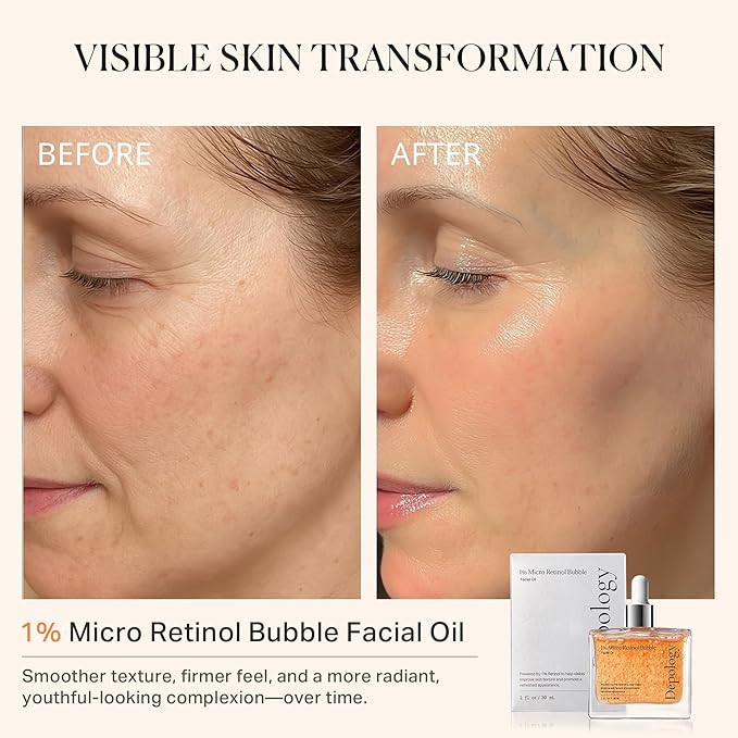 1% Retinol Face Oil with Firming, Smoothing & Glowing– Retinol Serum for Face, Lightweight Squalane Facial Oil for Fine Lines, Texture & Anti-Aging, Gentle for All Skin 1.01 fl oz-VivaGrace Women