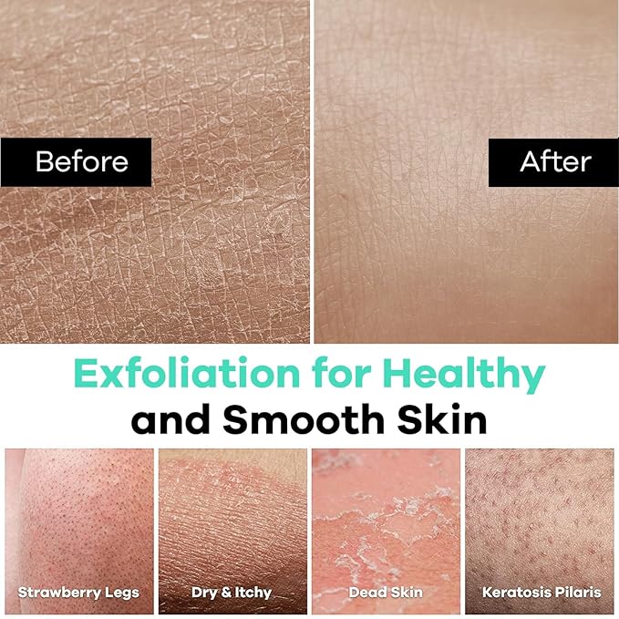 Dermasuri Deep Exfoliating Glove - Polishing Mitt Body Scrubber - Korean Skin Cleaner Exfoliator & Dead Skin Buffing Treatment - Keratosis Pilaris Scrub Remover- Shower Skincare (1 Pack)-VivaGrace Women