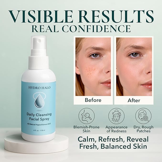 Hypochlorous Acid Spray for Face 4oz – Pure Hypochlorous Acid Spray Cleaner, Daily Cleansing Facial, pH Balanced, Plant Based, No Alcohol, USA Made-VivaGrace Women