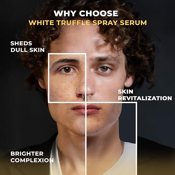 Italian White Truffle Spray Serum - Vegan Skin Care - Face Mist Hydrating Spray with Avocado & White Truffles - Face Serum for Radiant Skin - 3.38 Fl Oz-VivaGrace Women