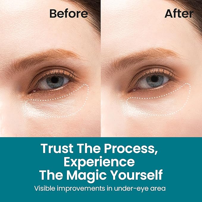 Under Eye Patches for Dark Circles | Korean Under Eye Patches & Puffy Eye Patches | Moisturizing Dark Circles Under Eye Treatment Skincare Snail Mucin Eye Patches & Dark Eyes Circle Treatment-VivaGrace Women