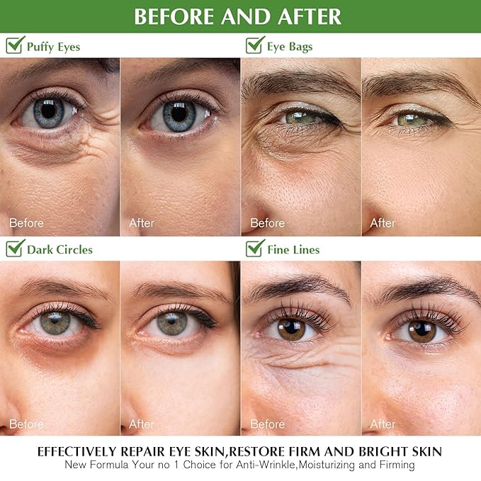 Under Eye Patches for Dark Circles: 30 Pairs Green Tea Eye Gels Pads - Reduce Eye Bags, Wrinkles & Puffy - Skin Treatment Mask Retinol Collagen - Anti Aging & Face Moisturizer For Women (Green Tea)-VivaGrace Women