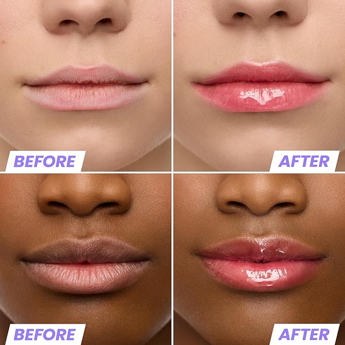 Wonderskin Lip Oil Rehab Serum - Tinted Lip Oil for Women, Hydrating, Moisturizing, and Non-Sticky Red Tint Serum for Dry Lips (Amour)-VivaGrace Women