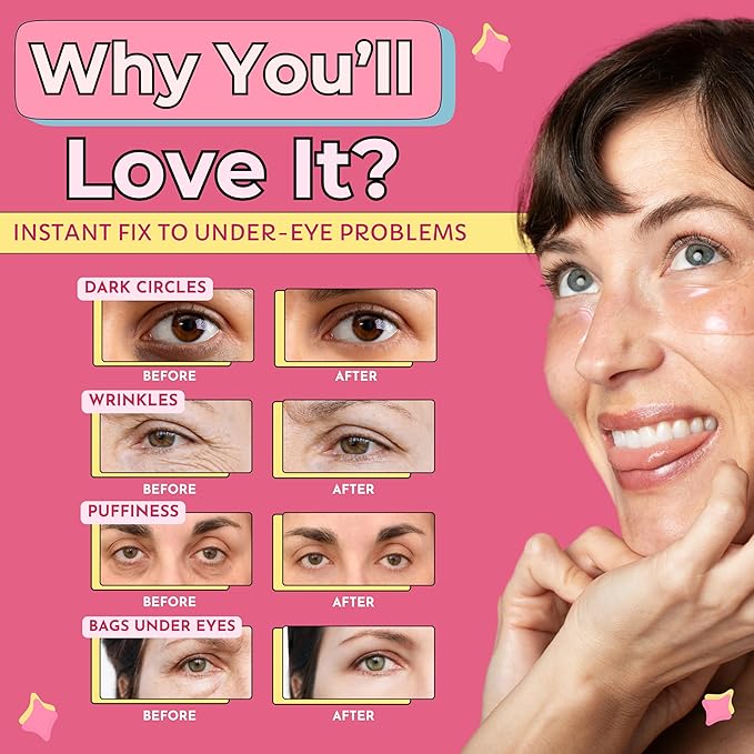 RevitalEyez Brightening Hydrogel Under Eye Patch with Niacinamide, Collagen & Rose Petals for Puffy Eyes, Wrinkles, Dark Circles (10 pairs)-VivaGrace Women