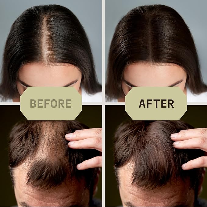 Striking Viking Hair Fibers for Thinning Hair - Building Fibers (Light Blonde) 28g - Naturally Derived Formula - Long Lasting Powder for Undetectable, Thicker Looking Results for Men & Women-VivaGrace Women