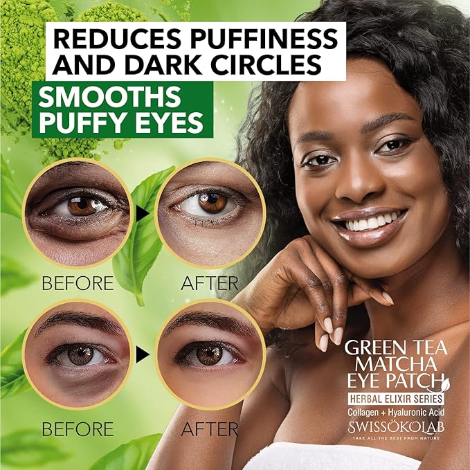 SWISSÖKOLAB Under Eye Patches For Puffy Eyes 24k Gold Eye Mask Dark Circles And Puffiness Collagen Eye Gel Pads Moisturizing & Reducing Wrinkles Anti-Aging Hyaluronic Acid (Green Tea)-VivaGrace Women