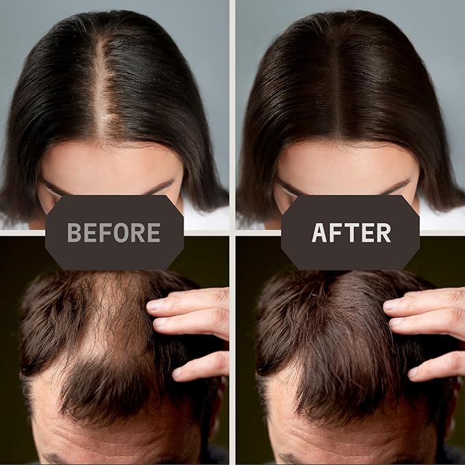 Striking Viking Hair Fibers for Thinning Hair (Medium Brown) 28g - Naturally Derived - Long Lasting Powder, Undetectable, Thicker Look for Men & Women-VivaGrace Women