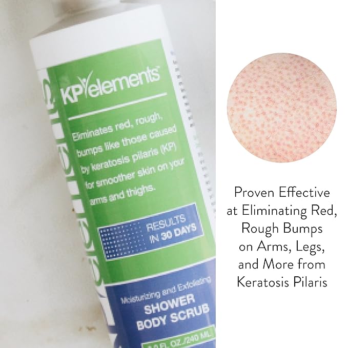 KP Elements Body Scrub (8 fl oz) | Keratosis Pilaris Treatment | Exfoliating Body Scrub and Body Moisturizer for Dry Skin | Helps Reduce Red Bumps | Body Skin Care Product for Men and Women-VivaGrace Women