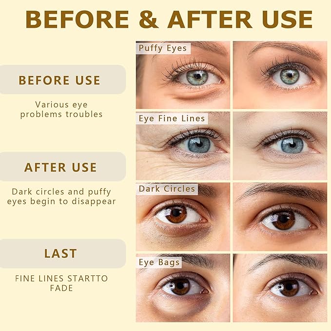 COSMETIC |24k Gold Vitality-Fill Hydra-Gel Eye Patches | Anti-Aging Under-Eye Patches, Help Boosting Lift & Firm the Look of the Eye Area-VivaGrace Women