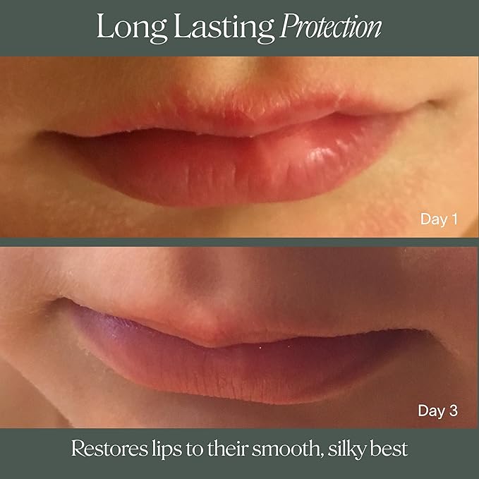 Doctor Rogers Lip Balm, Hydrating and Softening Lip Moisturizer For Very Dry Lips, Dermatologist-Created, Natural, & Hypoallergenic Moisturizing Lip Balms, 4.25g Tube, Pack of 3-VivaGrace Women