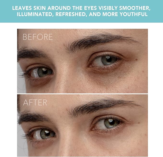 FOREO IRIS Eye Massager Dark Circle Remover & Eyebag Remover Eye Depuffer Anti Aging Increases Absorption of Eye Mask Essences| Waterproof 2-year Warranty Mint-VivaGrace Women