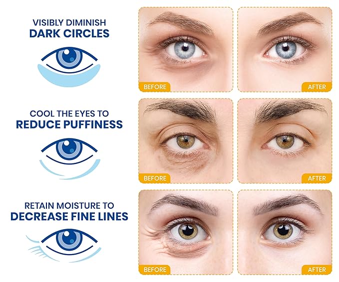 Stylia Under Eye Patches for Puffy Eyes and Dark Circles (20 Pairs) - 24k Gold Under Eye Mask with Vitamin C, Hyaluronic Acid, Pearl Extract - Eye Masks for Dark Circles and Puffiness-VivaGrace Women