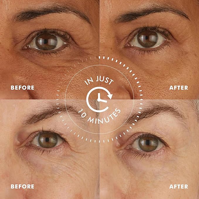 skyn ICELAND Hydro Cool Firming Under Eye Patches, Instant Cooling for Puffy, Tired Eyes with Peptides and Coenzyme Q10, 10 Minute Treatment, Vegan, All Skin Types, 8 Pairs-VivaGrace Women