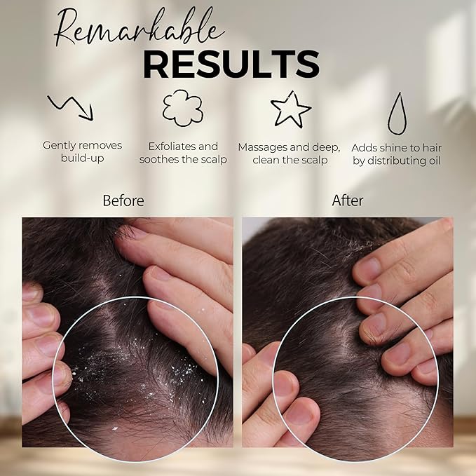 Fiora Naturals Scalp Massager Shampoo Brush - Silicon Scalp Scrubber & Exfoliator for Dandruff Removal and Hair Growth, Scalp Brush for Wet & Dry Hair, Shampoo Brush for Men, Women, Kids - BPA Free-VivaGrace Women