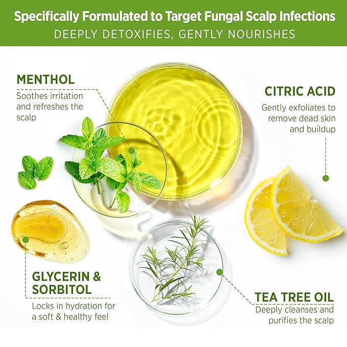 Roycederm Tea Tree Scalp Scrub: Anti Fungal Pre Shampoo, Itchy Relief Scalp Treatment for Dandruff, Psoriasis & Seborrheic Dermatitis - Gently Exfoliator, Relieves Dryness, Promotes Hair Growth-VivaGrace Women