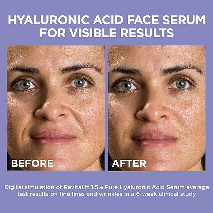 L'Oreal Paris Revitalift 1.5% Pure Hyaluronic Acid Face Serum 1.0 oz + True Match Lumi Glotion Natural Glow Enhancer Lotion, Medium 1.35 fl. oz, 1 kit-VivaGrace Women