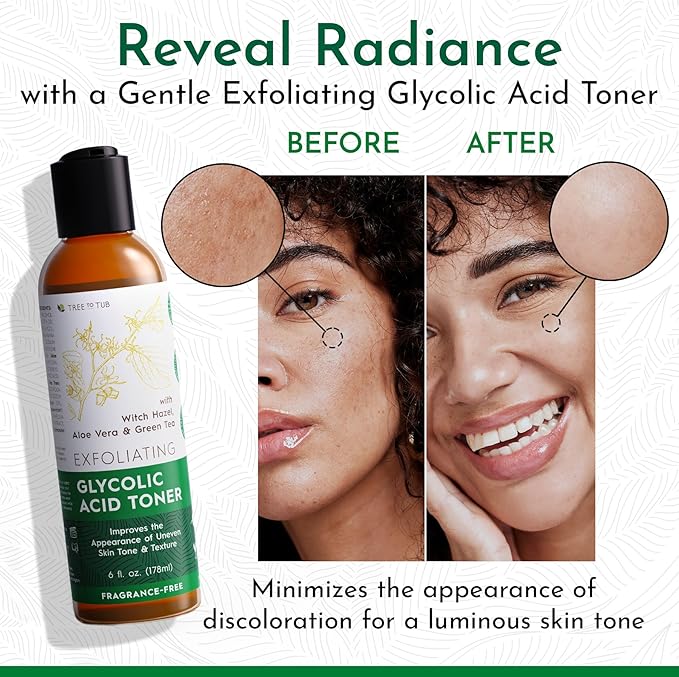 Tree To Tub Glycolic Acid Toner for Face w/Witch Hazel & Hydrating Aloe Vera for Smooth Skin - Minimizes Appearance of Fine Lines & Brightens - Vegan Exfoliating Toner for Women & Men-VivaGrace Women
